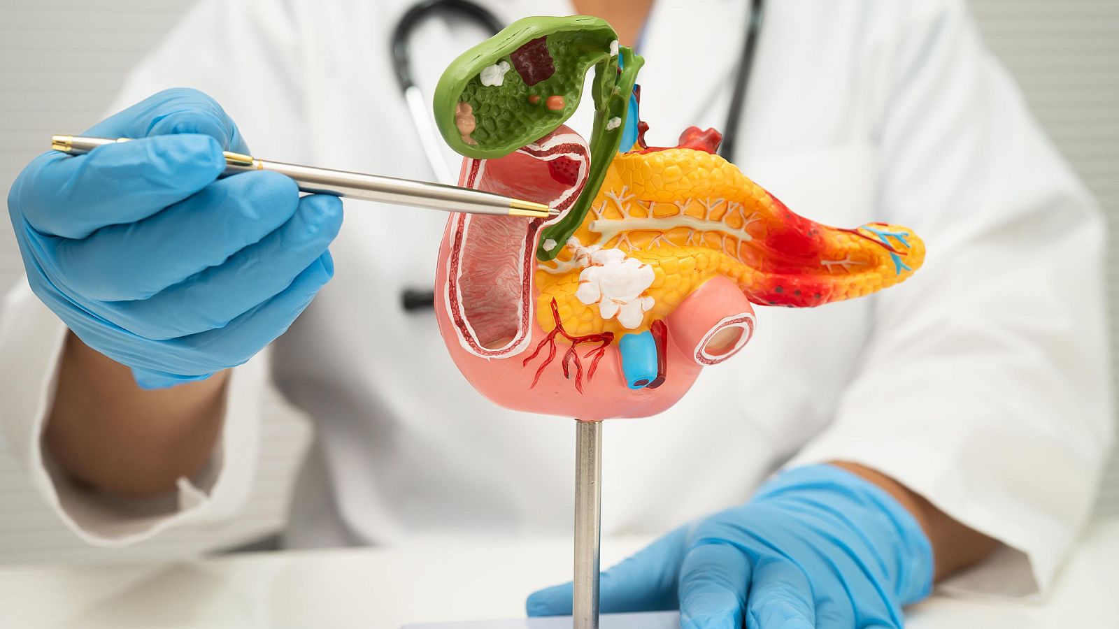 Desarrollan vacuna personalizada contra el cáncer de páncreas en Alemania